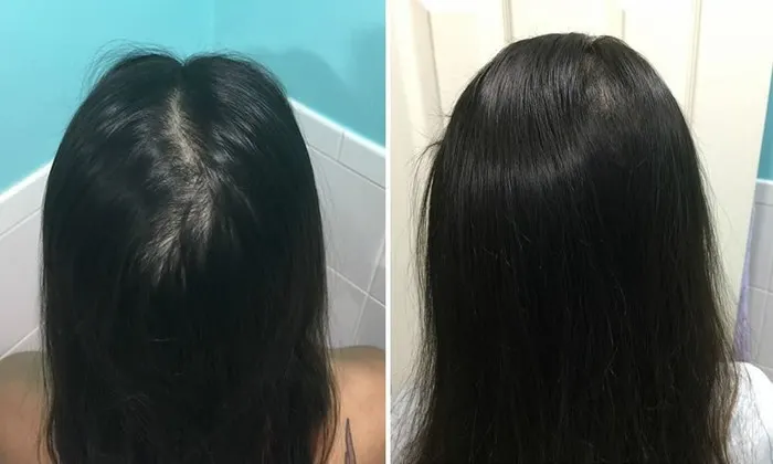 menumbuhkan rambut
