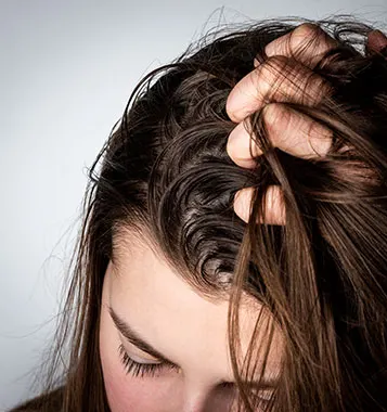 rambut berminyak